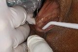 #13 Chlorhexidine-gluconate