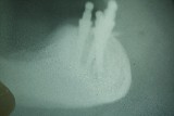 #16 Cephalometric x-ray