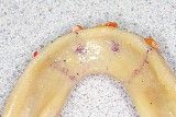 #9a retain-lower-denture